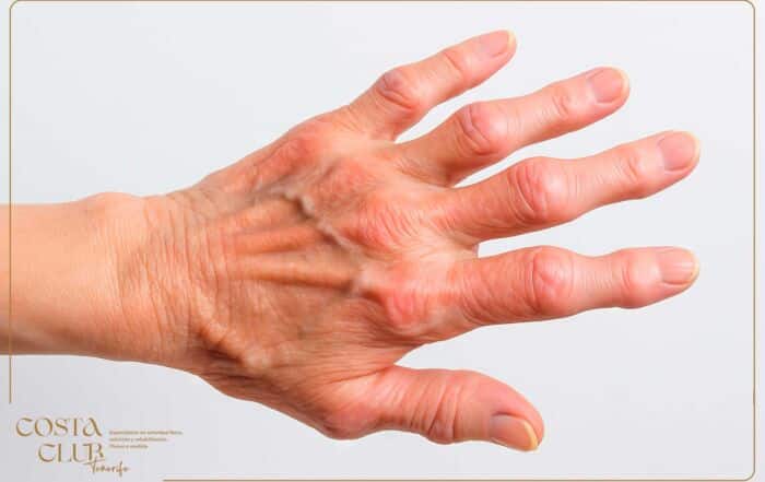 crujidos-articulares-blog - Costa Club Tenerife crujidos dedos y articulaciones
