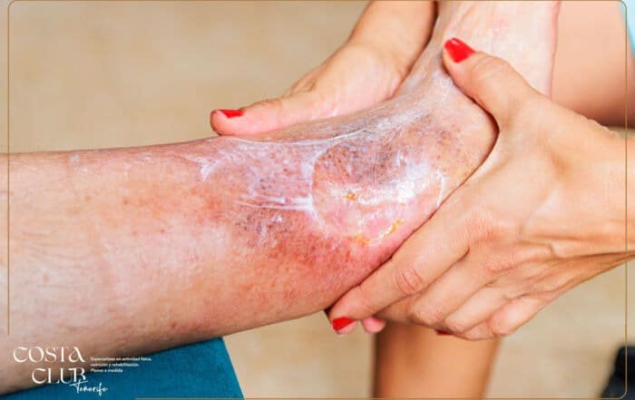 Fisioterapia-y-diabetes--una-terapia-que-quizás-no-conocías - Costa Club Tenerife la diabetes y la fisioterapia