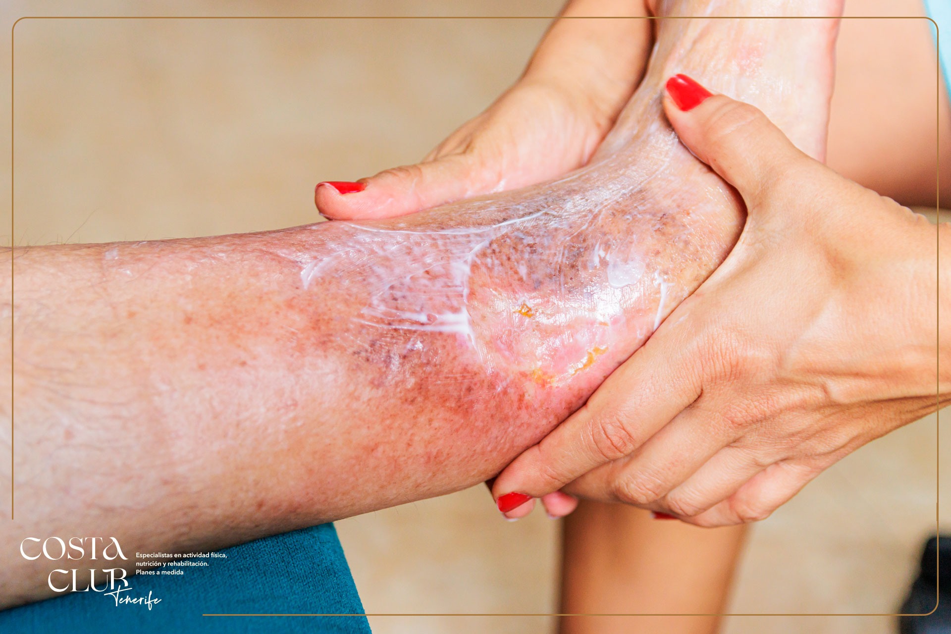 Fisioterapia-y-diabetes--una-terapia-que-quizás-no-conocías - Costa Club Tenerife la diabetes y la fisioterapia