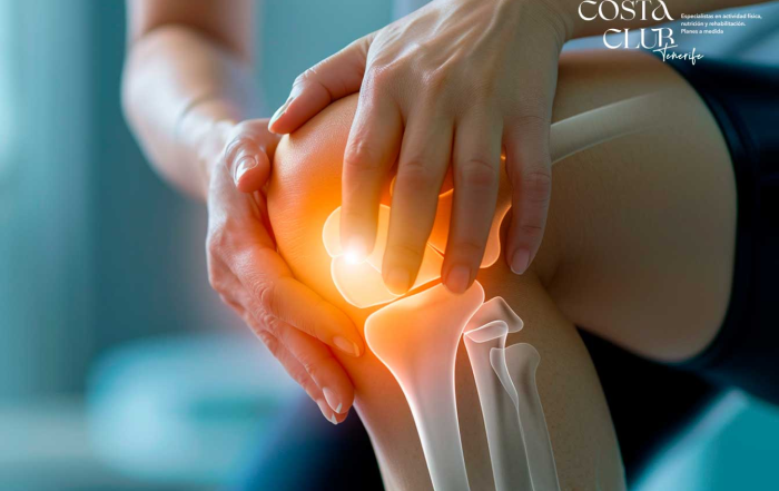 Artrosis-de-rodilla--qué-es-y-cómo-abordarla - Costa Club Tenerife artrosis de rodilla