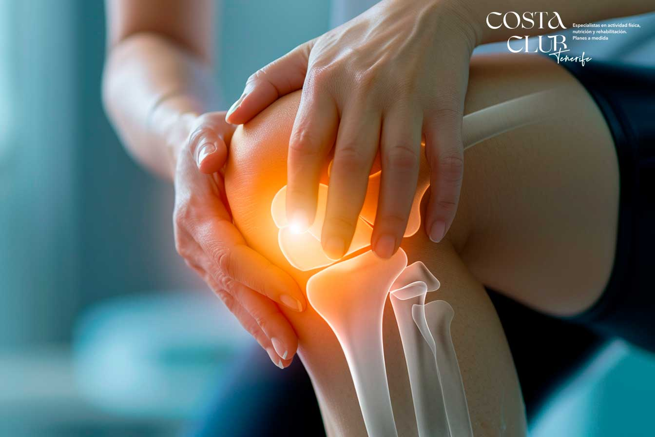 Artrosis-de-rodilla--qué-es-y-cómo-abordarla - Costa Club Tenerife artrosis de rodilla