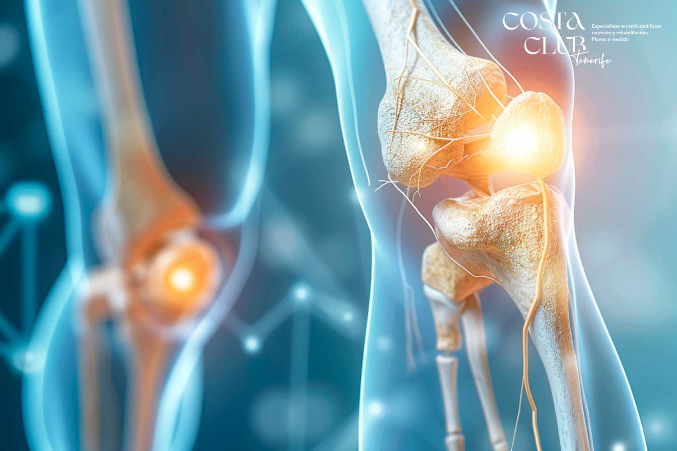 Todo-lo-que-debes-saber-sobre-el-crujir-rodilla--causas-y-soluciones - Costa Club Tenerife Todo lo que debes saber sobre el crujir rodilla: causas y soluciones