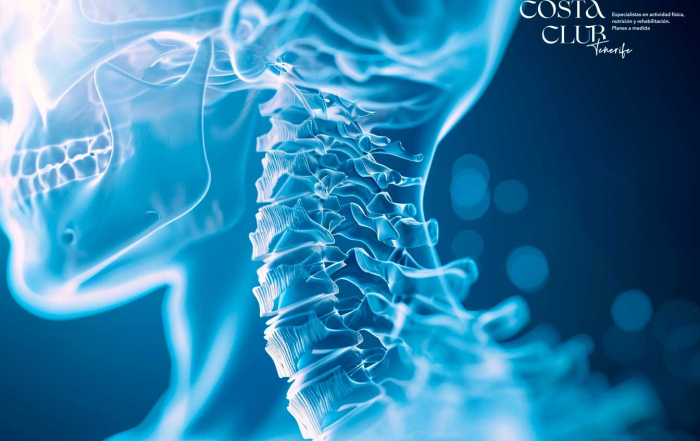 Dolor-en-las-cervicales-causas-tratamiento-y-consejos-para-aliviarlowebp - Costa Club Tenerife Dolor en las cervicales: causas, tratamiento y consejos para aliviarlo