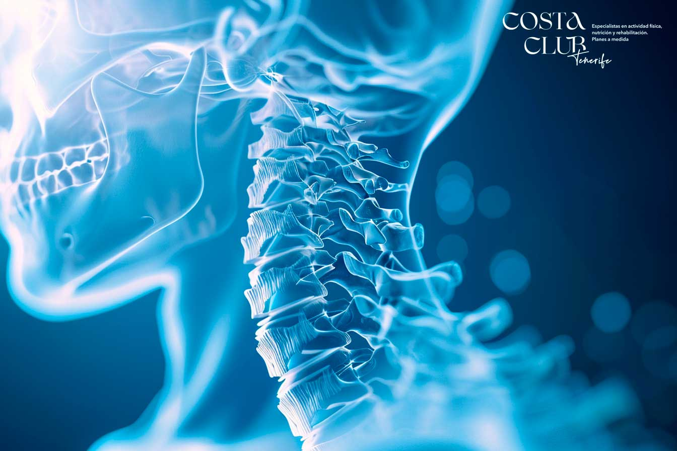 Dolor-en-las-cervicales-causas-tratamiento-y-consejos-para-aliviarlowebp - Costa Club Tenerife Dolor en las cervicales: causas, tratamiento y consejos para aliviarlo